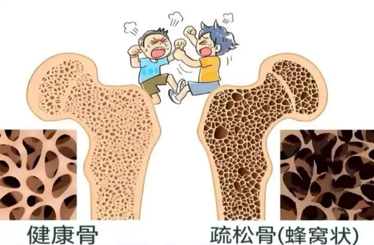 总觉得身体在垮掉?测测你的骨骼健康是否已陷入衰老危机?