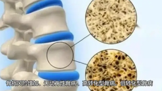 弯腰捡个快递都心慌？测测骨骼是否已透支安全感